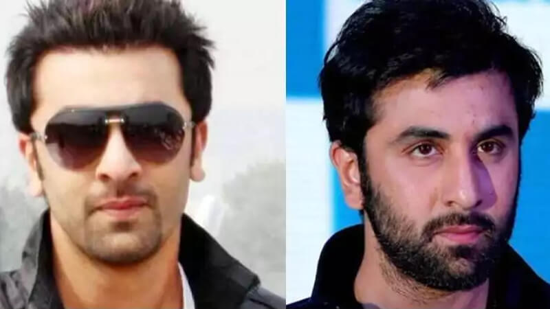 Ranbir Kapoor Hair Transplant