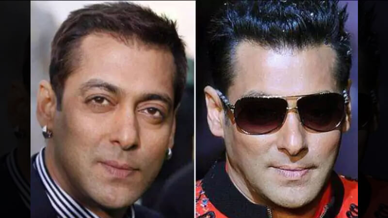 Salman Khan Hair Transplant