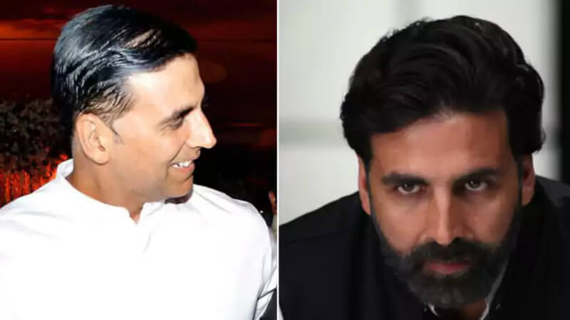 Akshay Kumar Hair Transplant