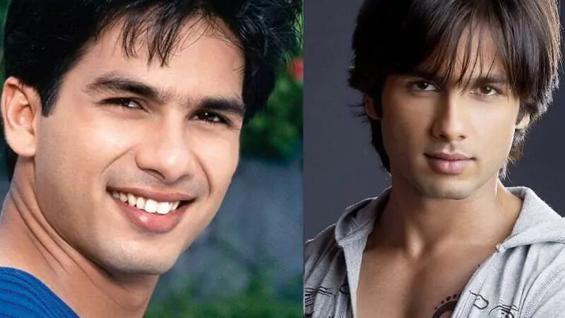 Shahid Kapoor Nose Surgery