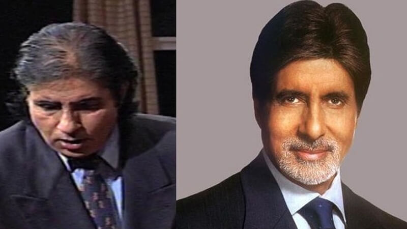 Amitabh Bachchan Hair Transplant Cosmetic surgeries