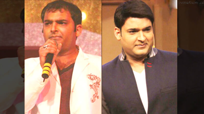 Kapil Sharma Hair Transplant