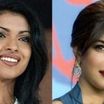 Priyanka Chopra Botched Nose Job Plastic Chopra