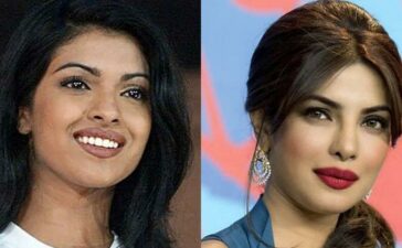 Priyanka Chopra Botched Nose Job Plastic Chopra