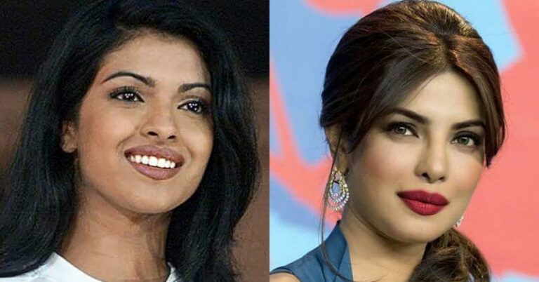priyanka chopra nose job Image 1