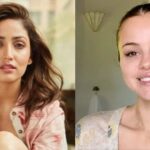 Celebrities Skin Problems